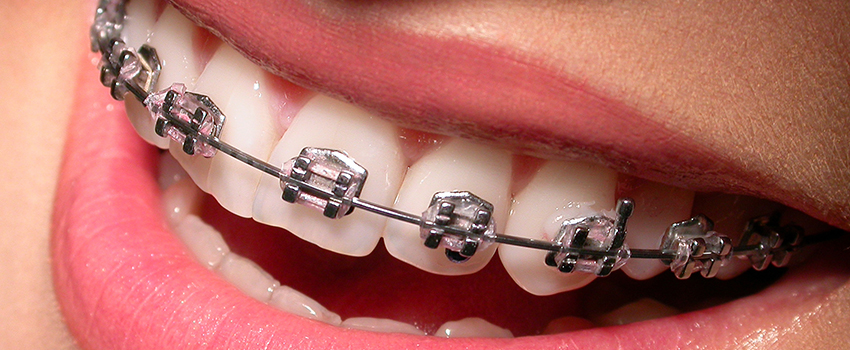 
Özel MaviDent Ağız ve Diş Sağlığı Polikliniği Ortodonti Tedavisi