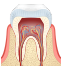 Periodontoloji